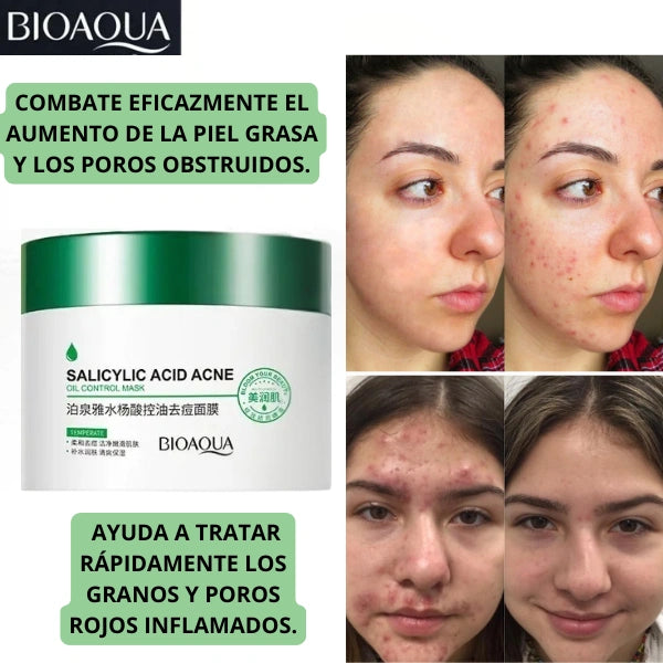 TRATAMIENTO PARA ACNE Y MANCHAS