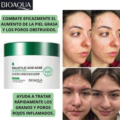 TRATAMIENTO PARA ACNE Y MANCHAS
