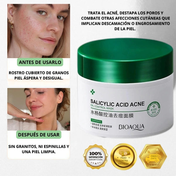 TRATAMIENTO PARA ACNE Y MANCHAS