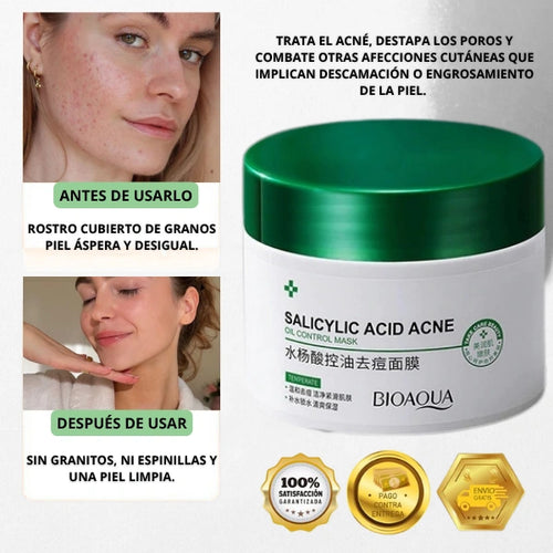 TRATAMIENTO PARA ACNE Y MANCHAS